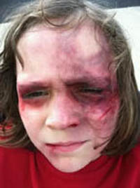 Jodi Byrne Special FX Makeup Artist Beaten Up Child